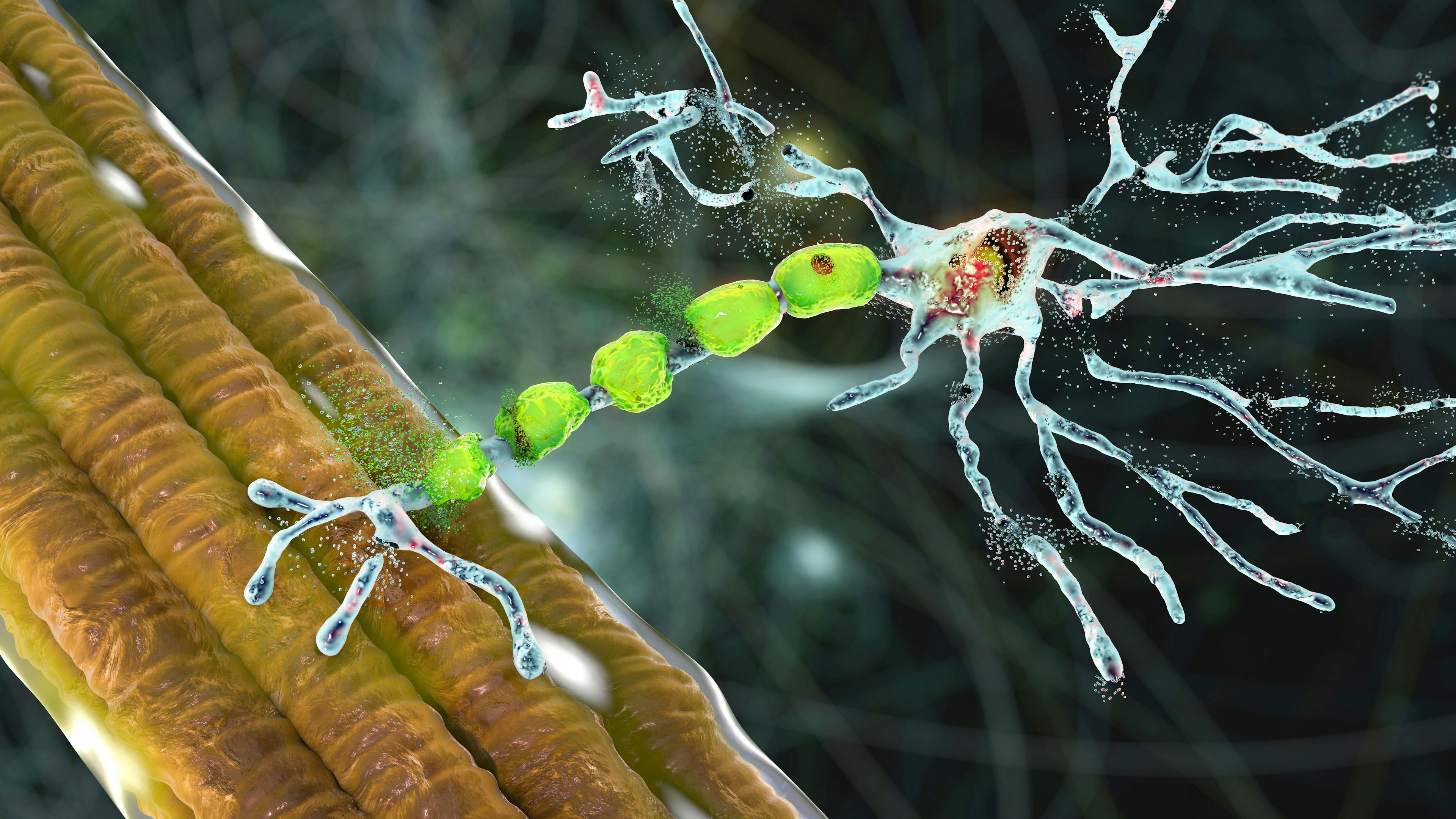 Neurodegeneration Concept | Image credit: Dr_Microbe - stock.adobe.com