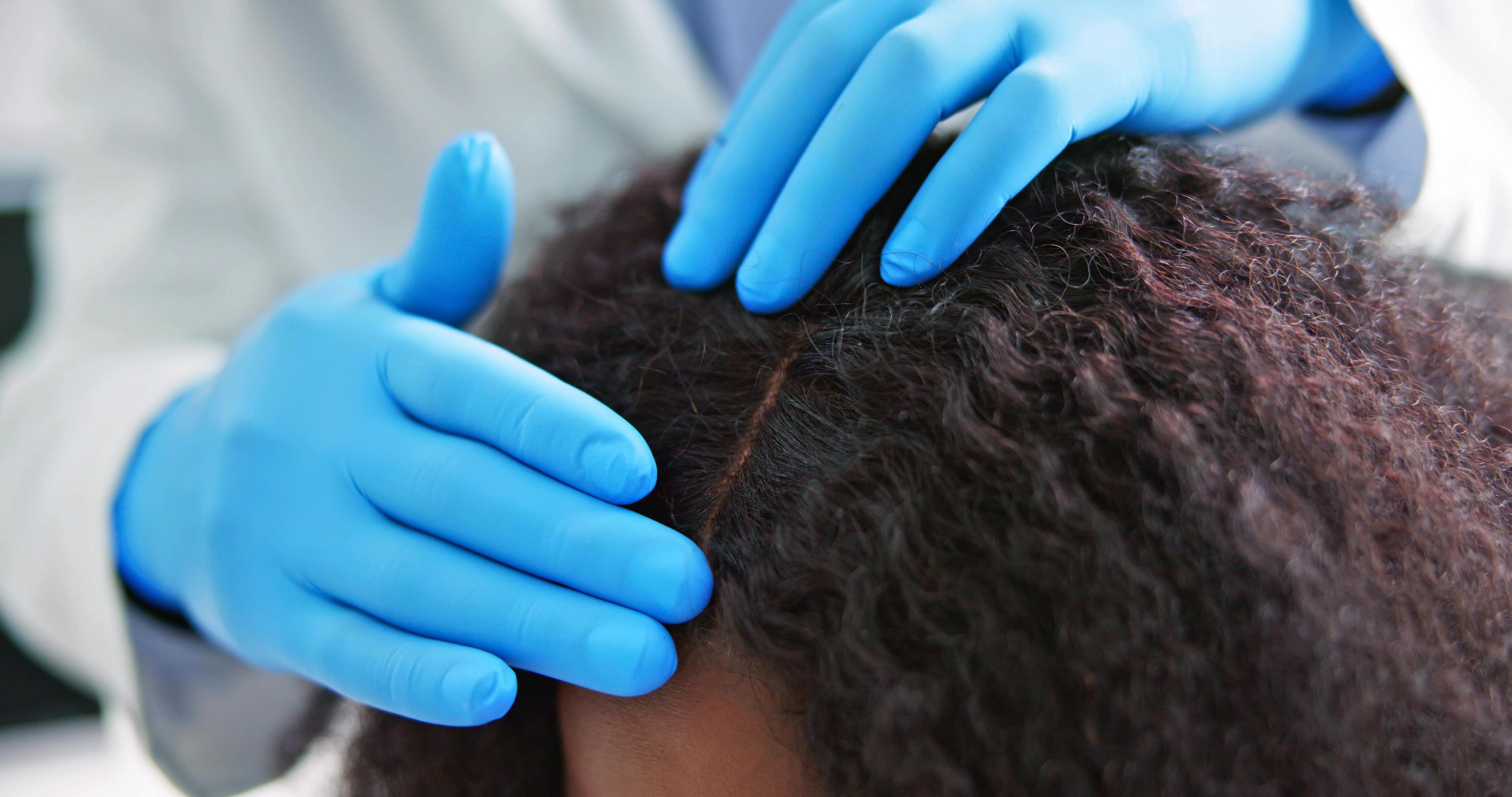 Dermatologist checks woman's scalp. | Image Credit: Andrey Popov - stock.adobe.com