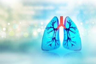 Macrolide Therapy Could Reduce Acute Exacerbations in Patients With COPD