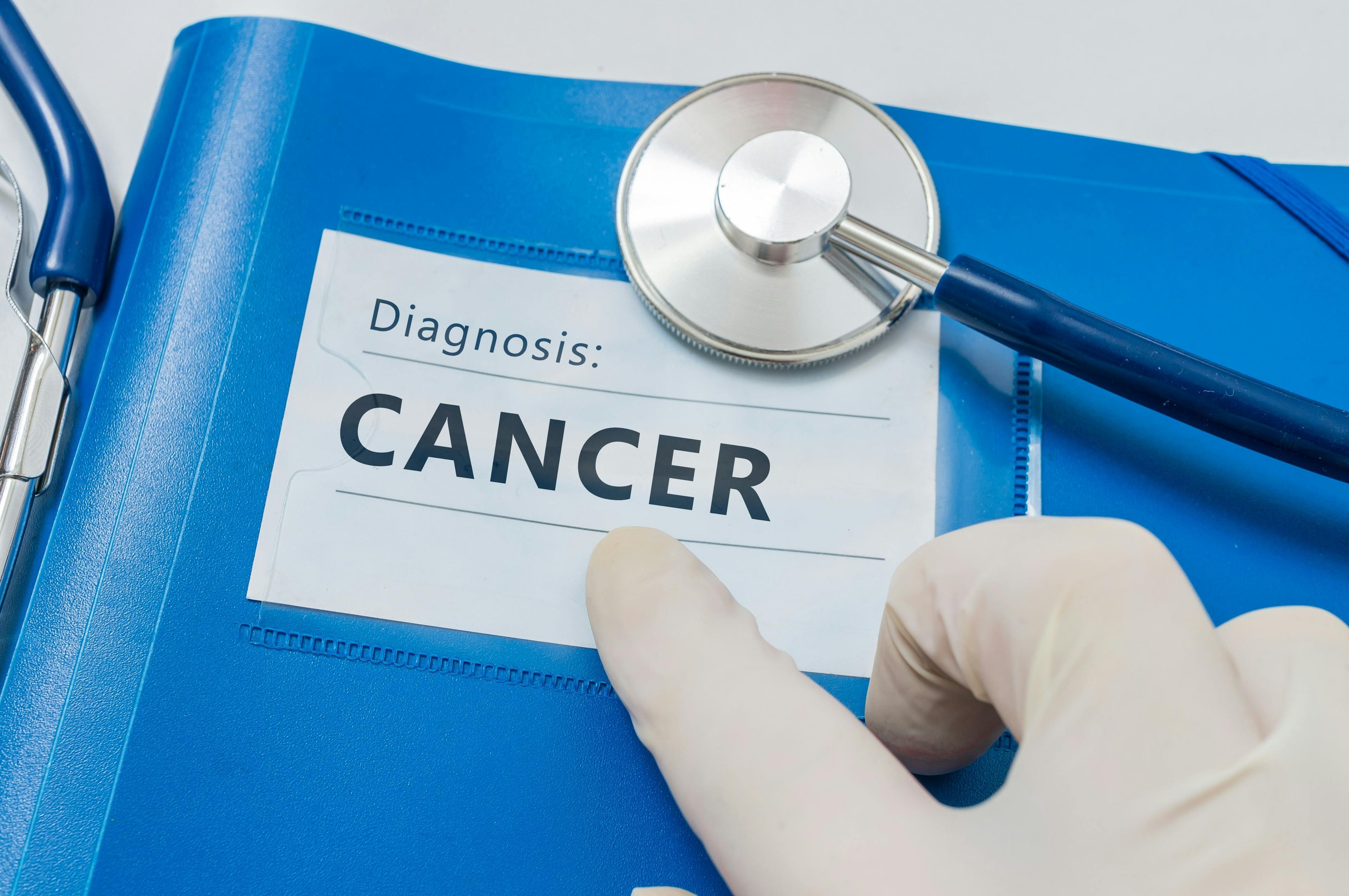 Blue folder with Cancer diagnosis | vchalup - stock.adobe.com