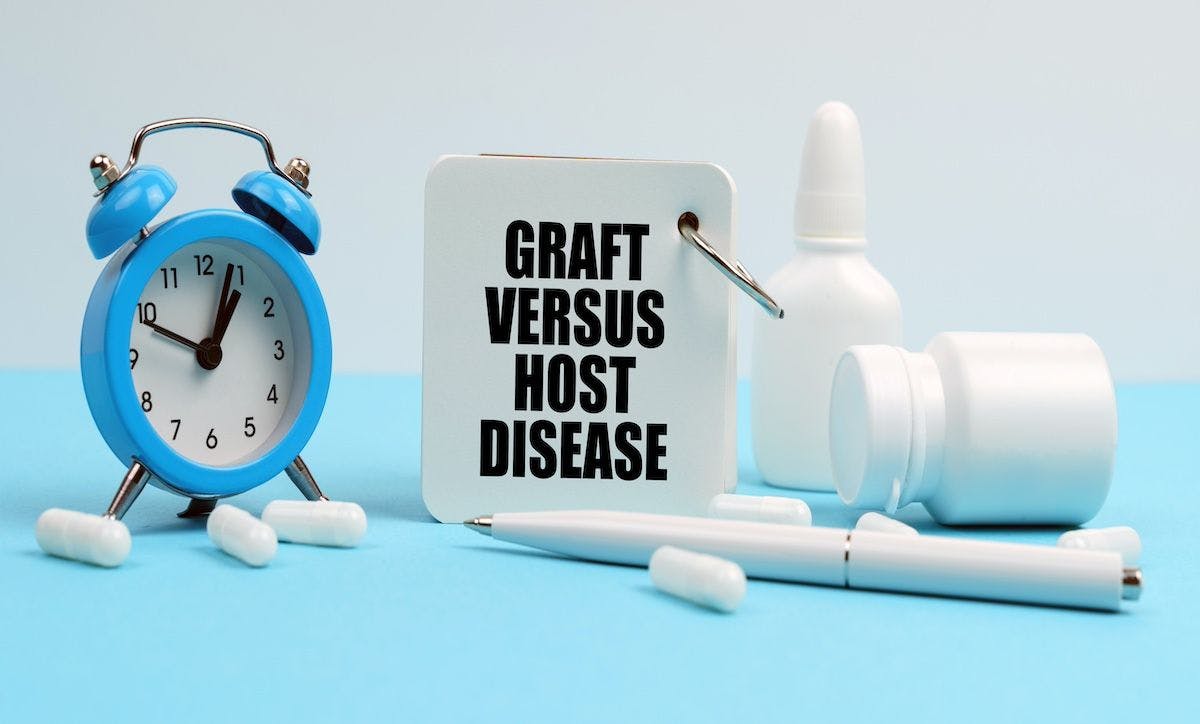 An alarm clock and a notebook with Graft Versus Host Disease | Image Credit: Dzmitry-stock.adobe.com