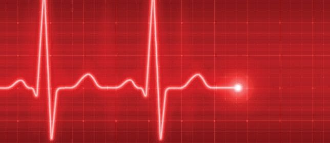 Heart Attack Survivors Have Reduced Risk of PD, Secondary Parkinsonism