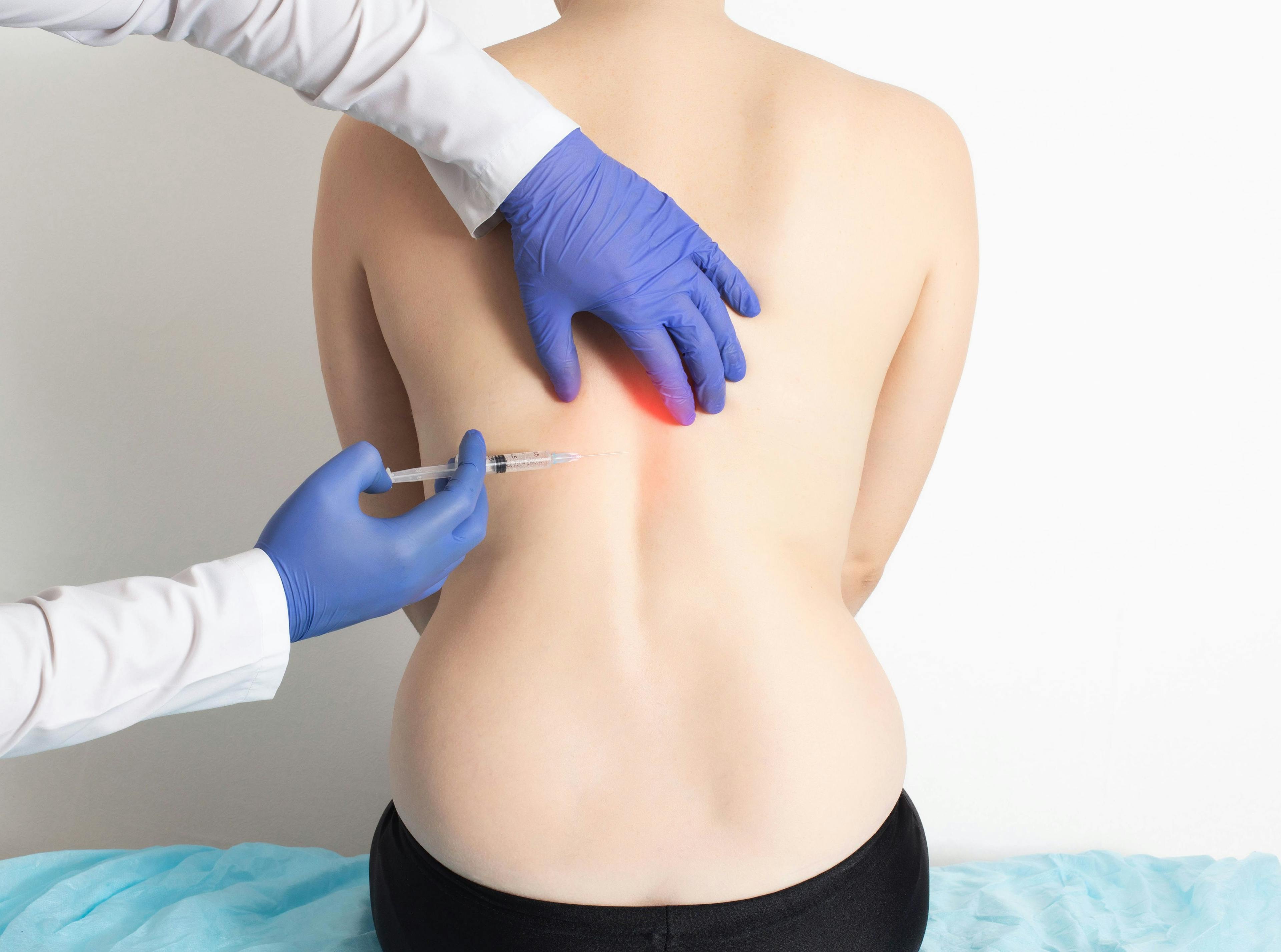 Patient receives injection of ozone therapy | Image Credit: HENADZY - stock.adobe.com