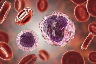 Triple-Therapy Combo Without Chemo to Be Studied in DLBCL