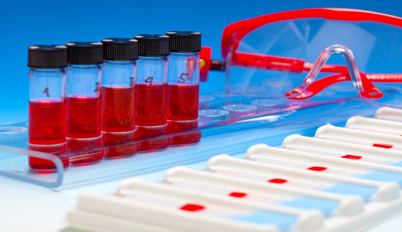 Array of blood samples for microscopy and biopsy tissue on blue: © motorolka - stock.adobe.com