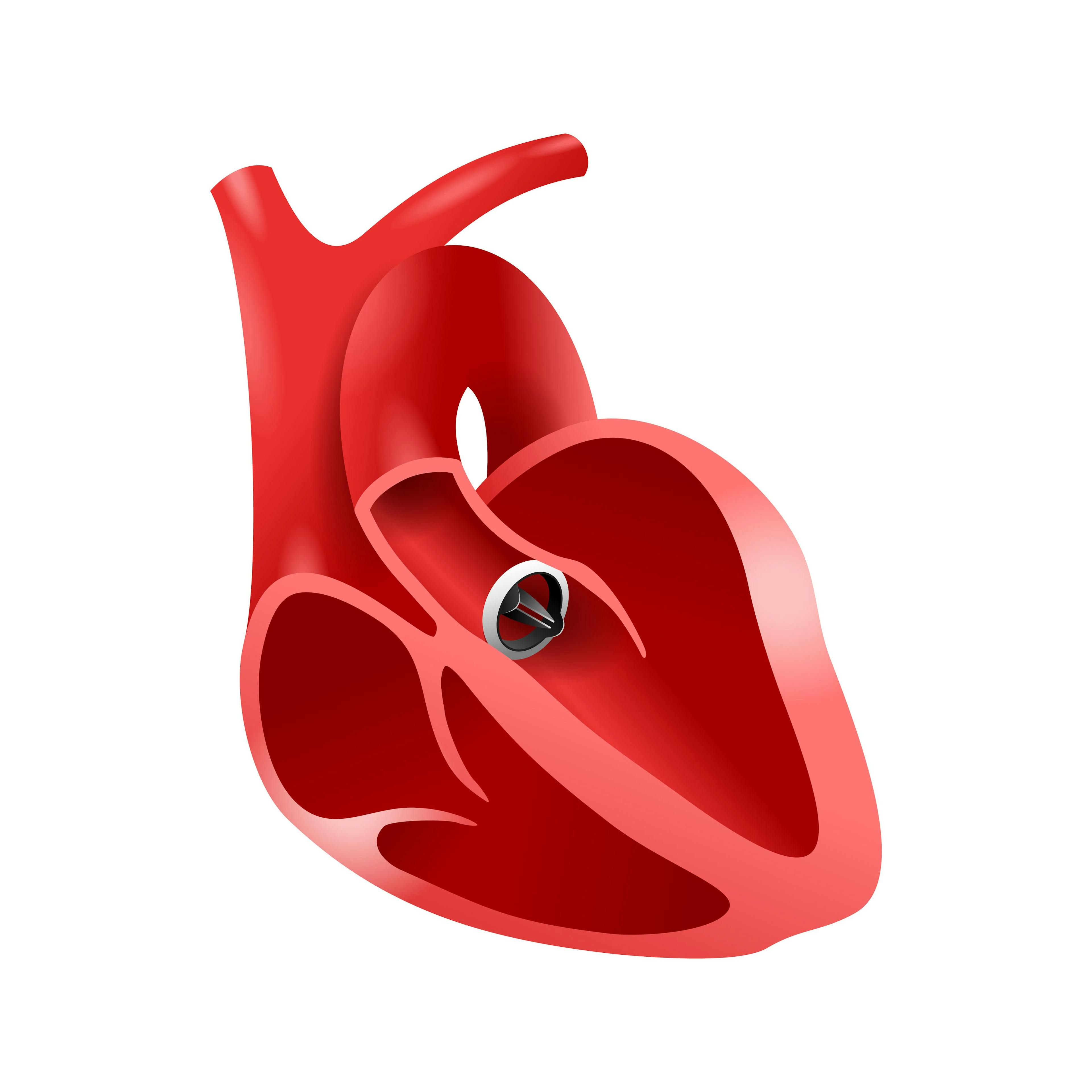 Artificial heart valve | Image Credit: Dmitry Kovalchuk – stock.adobe.com