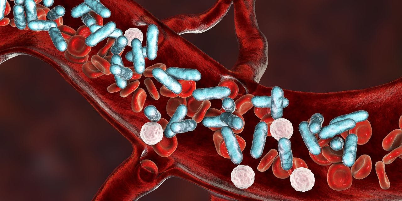 Sepsis Shown to Be Prevalent Among Patients With High HIV Viral Load