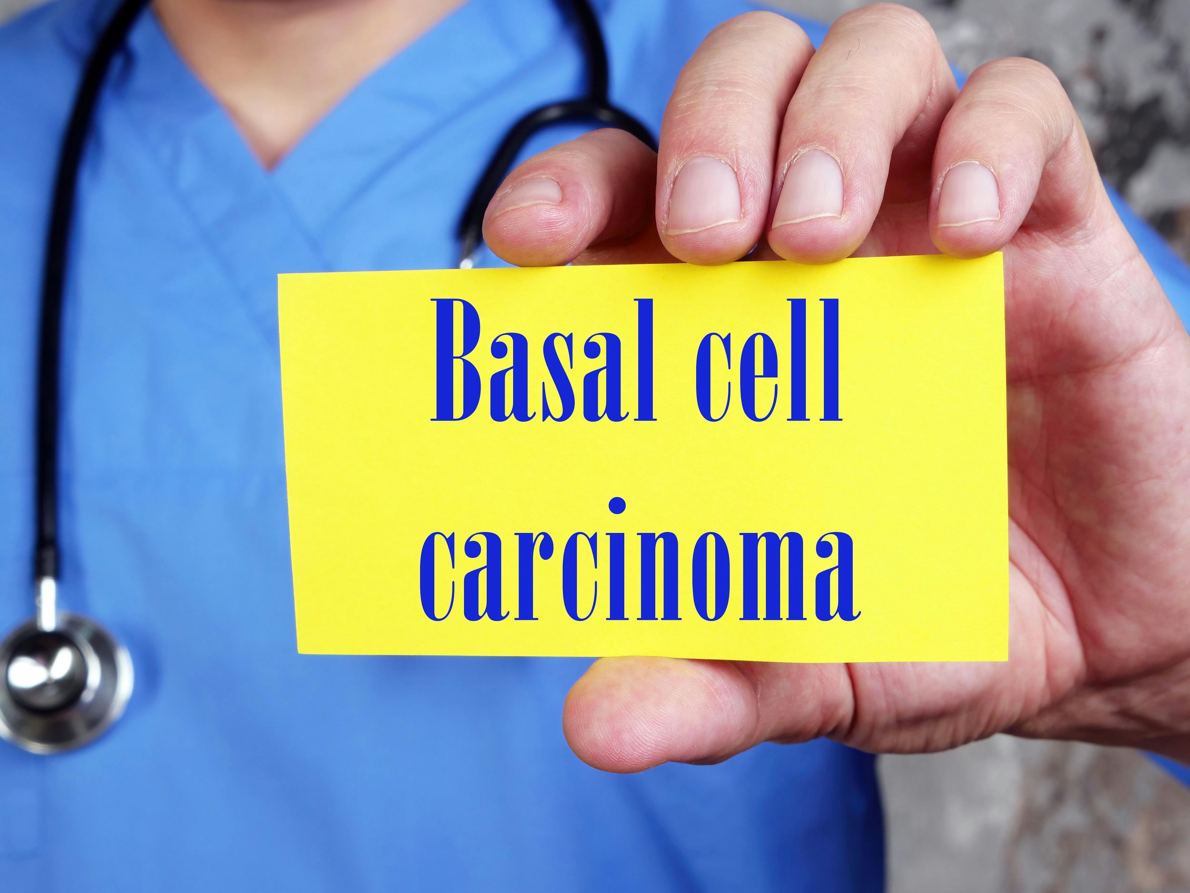 Sign Reading Basal Cell Carcinoma | image credit: Yurii Kibalnik - stock.adobe.com